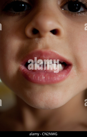 Ragazza con intercapedine in cui il dente mancante Foto Stock