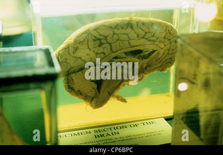 Un cervello umano in un museo medici Foto Stock