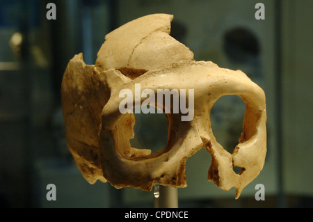 Cranio di Neanderthal (Homo neanderthalensis). Krapina. La Croazia. Museo di Storia Naturale. Londra. Regno Unito. Foto Stock