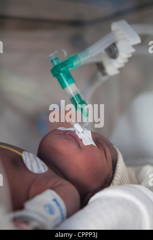 Caso di emergenza pediatrico Foto Stock