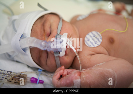 Caso di emergenza pediatrico Foto Stock