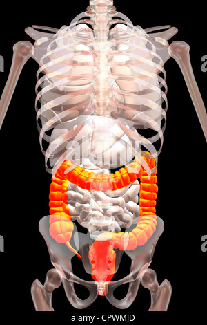 Illustrazione anatomica che mostra l'appendice, cieco e del colon Foto Stock