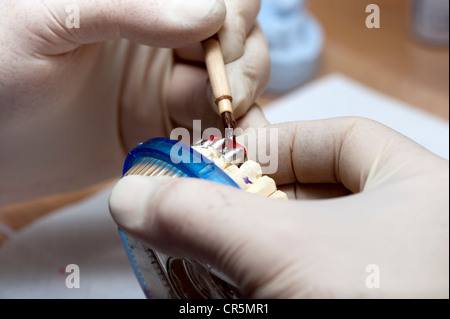 Lavoro in dettaglio sulla struttura in metallo del dente corona Foto Stock