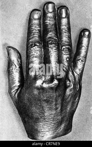 Wagner, Richard, 22.5.1813 - 13.2.1883, compositore tedesco, bronzo di sua destra, museo Richard Wagner, Eisenach, Foto Stock