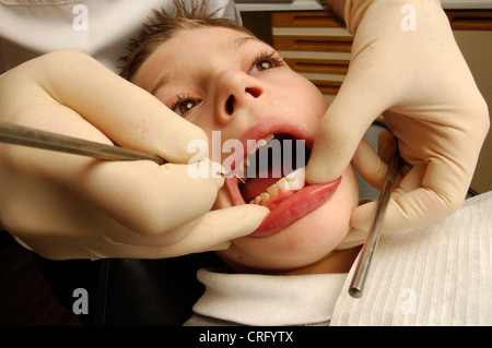 Un dentista raschia via la placca dai denti di un giovane paziente di sesso maschile. Foto Stock