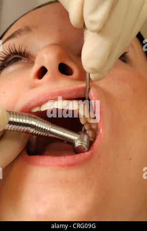 Close up di un trapano dentistico essendo utilizzato per rimuovere la parte di decadimento di una giovane ragazza dente. Foto Stock