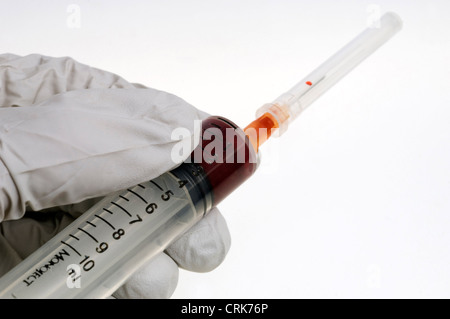 Vista di un ago fissato ad una siringa, la punta dell'ago contiene una gocciolina di sangue. Foto Stock