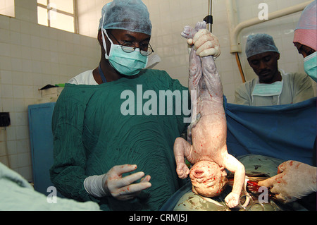 Il neonato è tenuta capovolta per aiutare a scaricare il liquido dai suoi polmoni. All'interno dell'utero, il feto è sospeso nel liquido amniotico; che agisce per il cuscino dal pregiudizio. Questo fluido linee le vie aeree dei polmoni, poiché essi non sono necessari per lo scambio di gas a questo punto. Tuttavia, del neonato nei polmoni saranno tenuti a prendere in consegna il cordone ombelicale del t Foto Stock