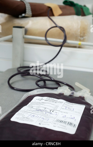 La donazione di sangue nel processo. Il sangue è prelevato dalla mediana cubital vena, utilizzando un ago di grande calibro per evitare di emolisi. Foto Stock