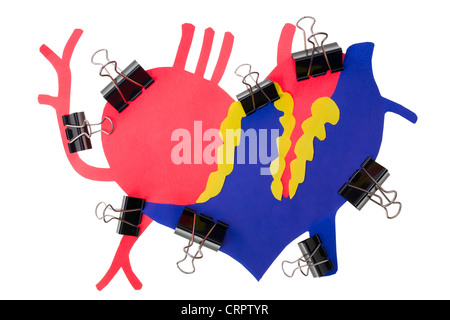 Infarto miocardico concetto del cuore umano. Un attacco di cuore. Cuore di carta colorata con una superficie ruvida è compressa st Foto Stock