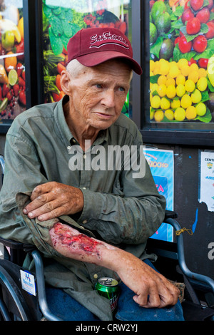 L'uomo visualizza il suo zucchero gli effetti del diabete, Baltimore, Maryland Foto Stock