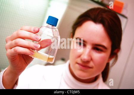 La sindrome di DOWN, ricerca Foto Stock