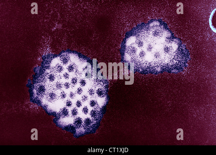 VIRUS DI NORWALK Foto Stock