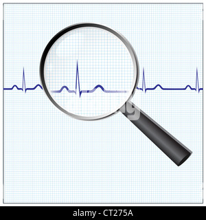 Cuore checkup, lente di ingrandimento su un ECG Foto Stock