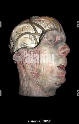 Cera modello anatomico con una parte del cranio rimossa esponendo il cervello Foto Stock