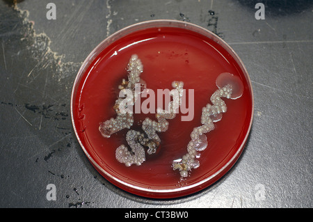 Coltura batterica che cresce in una capsula di petri su agar jelly. Foto Stock