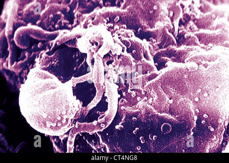 Il virus dell'AIDS infezione, SEM Foto Stock