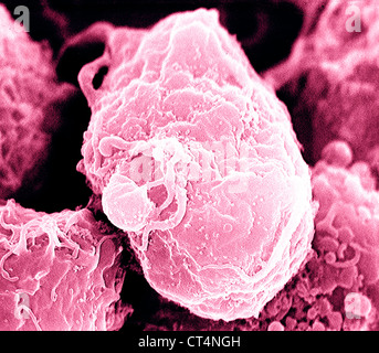 Il virus dell'AIDS infezione, SEM Foto Stock