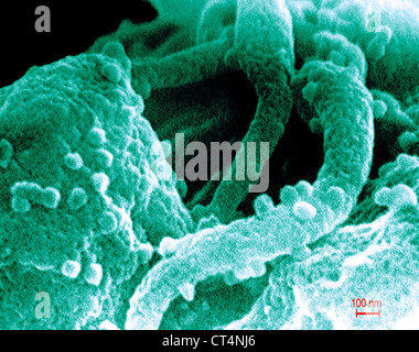 Il virus dell'AIDS infezione, SEM Foto Stock