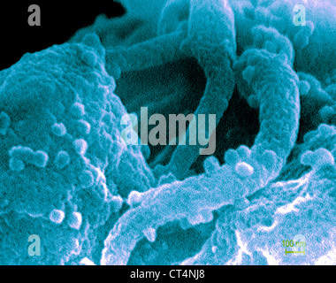 Il virus dell'AIDS infezione, SEM Foto Stock