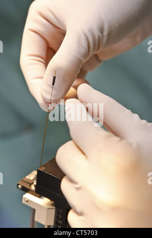 Elettrostimolazione del cervello Foto Stock