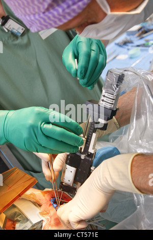 Elettrostimolazione del cervello Foto Stock