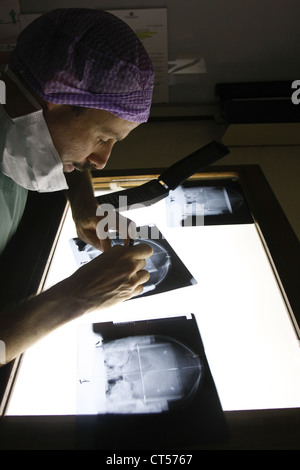 Elettrostimolazione del cervello Foto Stock