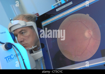 FUNDUS OCULI ESAME Foto Stock