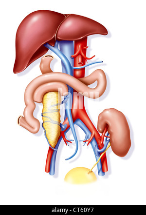 Rene-pancreas trapianto, ill. Foto Stock