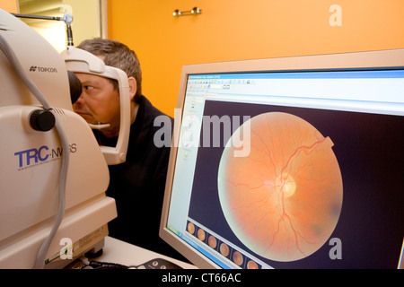 FUNDUS OCULI ESAME Foto Stock