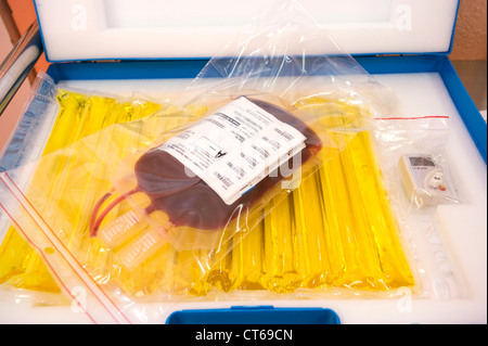 Trapianto di anima di cavo Foto Stock