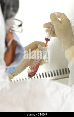 Il sangue del cordone ombelicale analysis Foto Stock