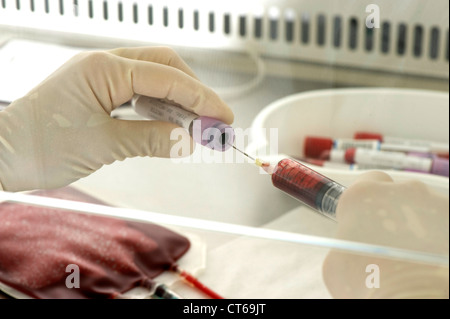 Il sangue del cordone ombelicale analysis Foto Stock