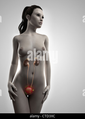 Femmina di infezione delle vie urinarie artwork Foto Stock