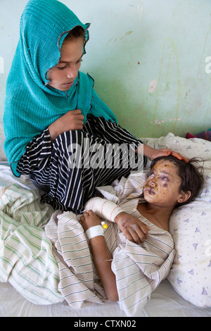 Vittime di un roadsidebomb nella provincia di Kunduz, Afghanistan Foto Stock