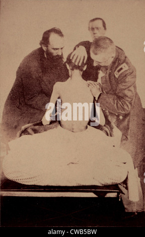 La guerra civile, i medici esaminando un prigioniero federale restituiti dalla prigione, fotografia circa 1861-1865. Foto Stock
