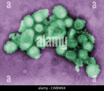 Questo colorato colorato negativo micrografia elettronica a trasmissione di A/CA/4/09 influenza suina virus. 2009 foto di C. S. Foto Stock