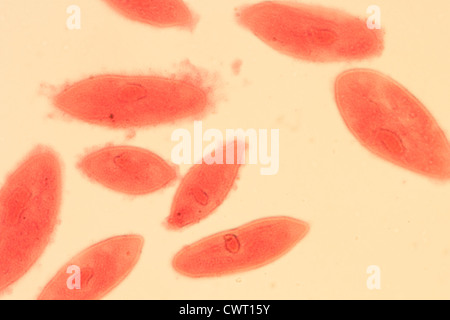 Micrografia di microscopia animale, la coniugazione di paramecio caudatum, ingrandimento 200X Foto Stock