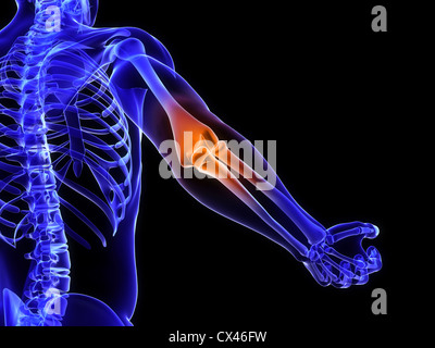 Rendering 3d Illustrazione medica di una borsite Foto Stock