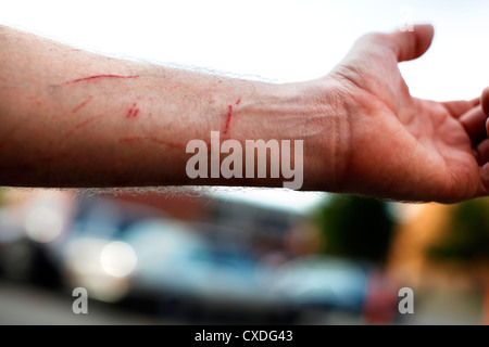 Graffi sul avambraccio maschio. Foto Stock