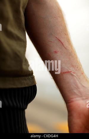 Graffi sull'uomo del braccio. Foto Stock