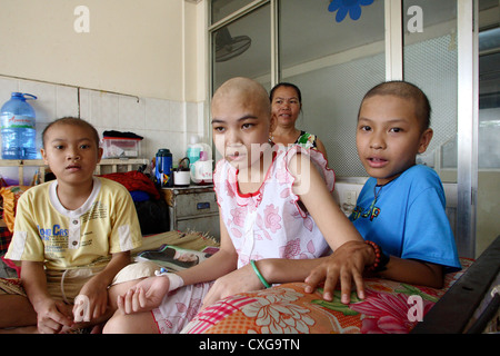 In un reparto di cancro di un ospedale cancro-colpiti i bambini seduti su un letto Foto Stock