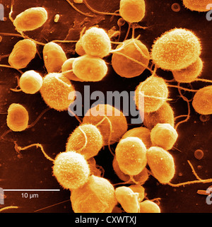 Micrografia elettronica a scansione di alghe Foto Stock