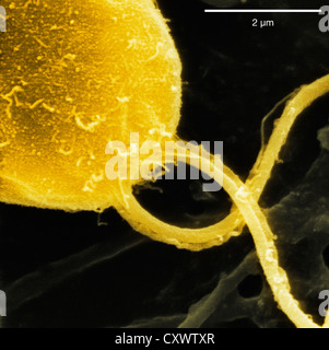 Micrografia elettronica a scansione di alghe Foto Stock