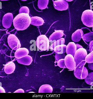 Micrografia elettronica a scansione di alghe Foto Stock