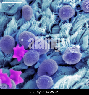 Micrografia elettronica a scansione di epitelio polmonare Foto Stock