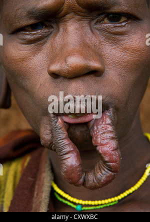 Suri Tribe donna con un ingrandimento di un labbro, Kibish, Valle dell'Omo, Etiopia Foto Stock