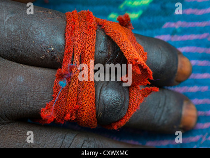 Dita rotto dopo un donga lotta, Kibish, Valle dell'Omo, Etiopia Foto Stock