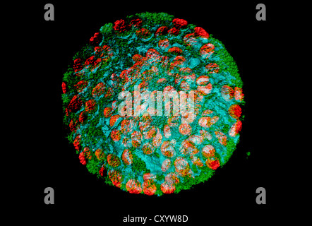 Nicotiana benthamiana leaf protoplasti esprimenti GFP. La parete cellulare è stato rimosso mediante trattamento con enzimi. Foto Stock