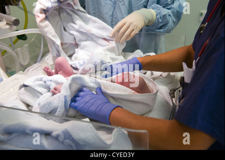 Un neonato momenti dopo che è stato erogato mediante taglio cesareo essendo frequentato da un pediatra e ostetrica Foto Stock